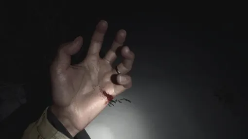 『バイオハザード ヴィレッジ』におけるイーサンの手の怪我集